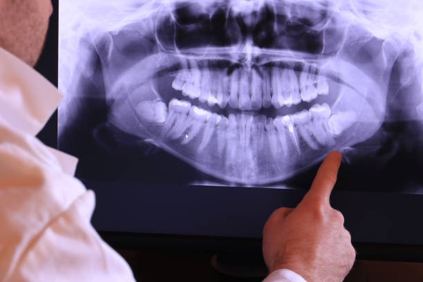 Best Emergency Cosmetic Dentistry in Graton, CA